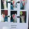 متخصص زخمهای عفونی در تهران