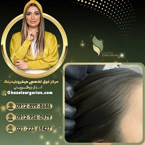 آموزش اسکالپ سر با غزل زرگریان