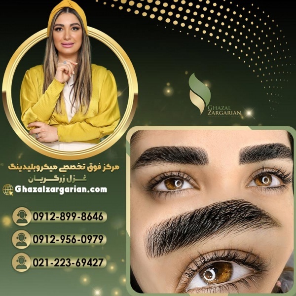 بلید کرکی مویی در تهران