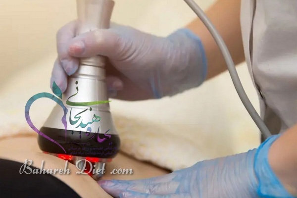 لاغری، فرم دهی و لیفت پوست با دستگاه RF