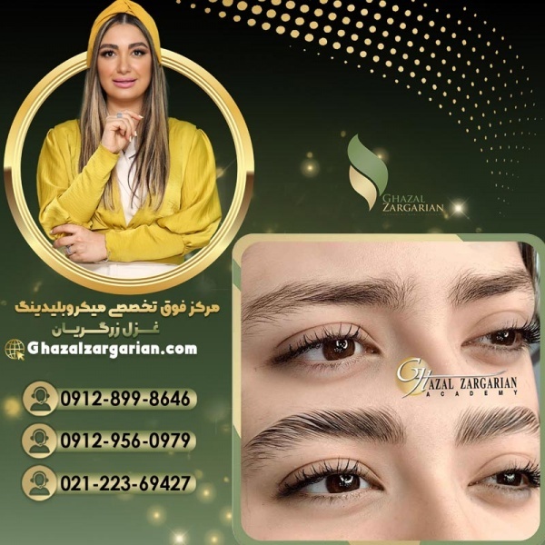 هزینه لیفت ابرو با مواد در آکادمی غزل زرگریان