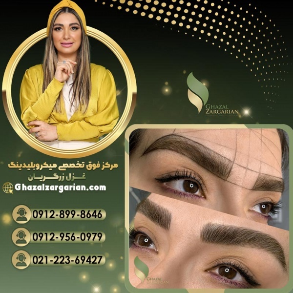 میکروبلیدینگ غزل زرگریان با بهترین روش