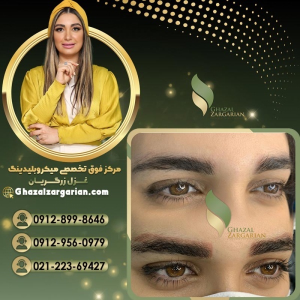 بهترین مرکز ریموو ابرو در تهران با بیشترین تخصص